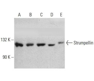 western blotting image from recommended Strumpellin (B-10) monoclonal antibody replacement. Image 384517