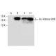 Suberoylanilide Hydroxamic Acid: sc-220139. Western blot analysis of Histone H2B acetylation in untreated (A,C) and Subero