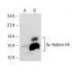 Western blot analysis of Histone H4 acetylation in untreated (A) and Suberoylanilide Hydroxamic Acid (sc-220139) treated ( 