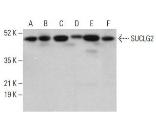 SUCLG2 Antibody (A-2) - Western Blotting - Image 376673 