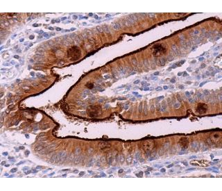 immunohistochemistry image from recommended Sucrase-Isomaltase (A-12) monoclonal antibody replacement. Image 372124