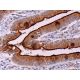 immunohistochemistry image from recommended Sucrase-Isomaltase (A-12) monoclonal antibody replacement. Image 372124