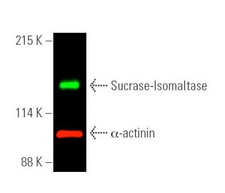 Sucrase-Isomaltase Antibody (A-12) - Western Blotting - Image 390289 