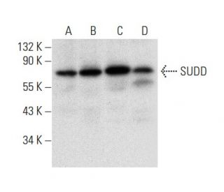 SUDD Antibody (B-3) - Western Blotting - Image 303402 