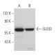 SUDD Antibody (B-3) - Western Blotting - Image 366747
