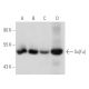 western blotting image from recommended Su[fu] (F-4) monoclonal antibody replacement. Image 55082