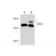 SUG1 Antibody (35) - Western Blotting - Image 73231