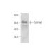 SUHW1 Antibody (H-3) - Western Blotting - Image 333796