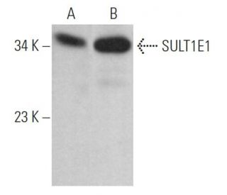 SULT1E1 Antibody (E-12) - Western Blotting - Image 364457Each CRISPR/Cas9 Knockout (KO) Plasmid product consists of a pool of 3 plasmids designed to ensure identification and cleavage of a specific gene for maximum knockout efficiency. Each plasmid encodes a unique 20 nt sequence derived from the GeCKO (v2) library. 