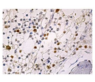 SULT2B1 Antibody (A-3) - Immunohistochemistry - Image 159222 
