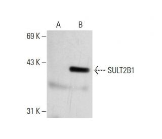 SULT2B1 Antibody (G-3) - Western Blotting - Image 73237