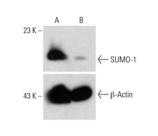 SUMO-1 HDR Plasmid (h): sc-417721-HDR. Western blot analysis of SUMO-1 expression in non-t300ransfected control (A) and puEach CRISPR/Cas9 Knockout (KO) Plasmid product consists of a pool of 3 plasmids designed to ensure identification and cleavage of a specific gene for maximum knockout efficiency. Each plasmid encodes a unique 20 nt sequence derived from the GeCKO (v2) library.