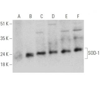 Superoxide Dismutase 1/SOD1 Antibody (C-8) - Western Blotting - Image 346510
