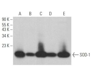 Superoxide Dismutase 1/SOD1 Antibody (24) - Western Blotting - Image 364707 