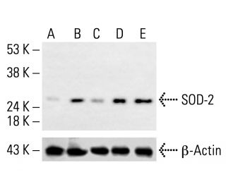 Superoxide Dismutase 2/SOD2 Antibody (A-2) - Western Blotting - Image 412819