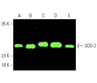 Superoxide Dismutase 2/SOD2 Antibody (A-2) - Western Blotting - Image 400103