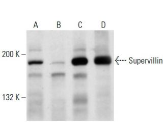 Supervillin Antibody (B8C1) - Western Blotting - Image 14963