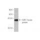 western blotting image from recommended SUR-1 (3G5) monoclonal antibody replacement. Image 348859