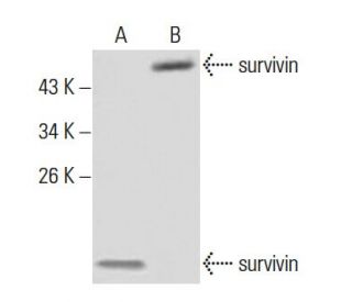 survivin Antibody (2H5H2) - Western Blotting - Image 137459 