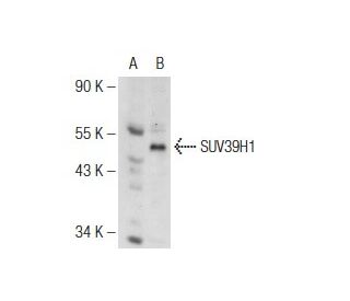 SUV39H1 Antibody (44.1) - Western Blotting - Image 126156 