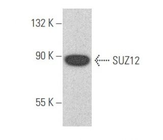 SUZ12 Antibody (D-10) - Western Blotting - Image 355669The Double Nickase Plasmid features a U6 promoter for sgRNA expression, a 20 nt targeting sequence, and a gRNA scaffold to guide Cas9n. It includes a CBh promoter for Cas9n (D10A) and puromycin resistance, GFP for transfection verification, and nuclear localization signals (NLS). The 2A peptide allows co-expression of Cas9n and Puro from a single promoter, enabling precise genome editing with reduced off-target effects.