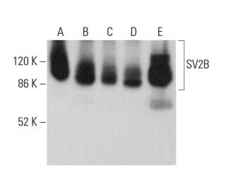 western blotting image from recommended SV2B (F-7) monoclonal antibody replacement. Image 379873