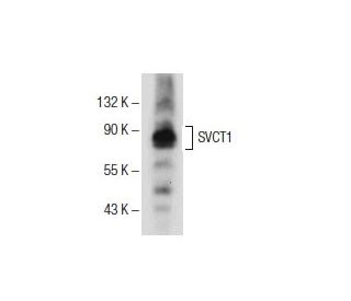 western blotting image from recommended SVCT1 (H-11) monoclonal antibody replacement. Image 153951