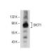 This polyclonal antibody has been discontinued. See our recommended <a href="svct1-antibody-h-11">SVCT1 (H-11)</a> monoclonal antibody (sample data shown). western blotting image from recommended SVCT1 (H-11) monoclonal antibody replacement. Image 153951
