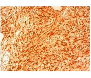 SYF2 Antibody (B-11) - Immunohistochemistry - Image 305563 