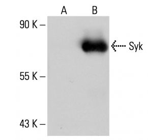 Syk Antibody (6A464) - Western Blotting - Image 20086 