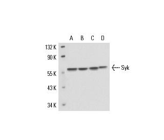 Syk Antibody (6D784) - Western Blotting - Image 17202 