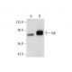 Syk Antibody (6D784) - Western Blotting - Image 131842