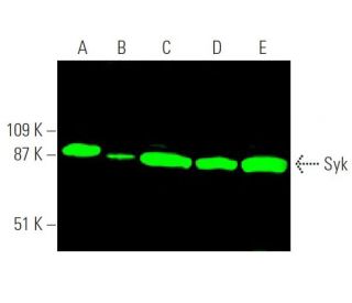 western blotting image from recommended Syk (4D10) monoclonal antibody replacement. Image 372650