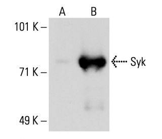 Syk Antibody (4D10) - Western Blotting - Image 20014