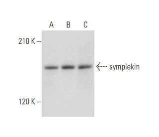 symplekin Antibody (E-2) - Western Blotting - Image 318355 
