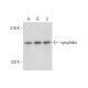 symplekin Antibody (E-2) - Western Blotting - Image 318355 