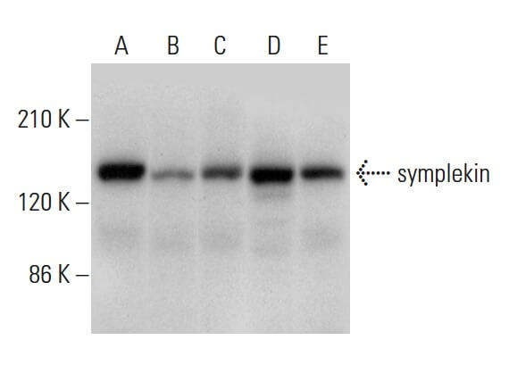 symplekin抗体(G-6) | SCBT - Santa Cruz Biotechnology