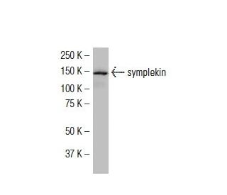 symplekin Antibody (YI-9) - Western Blotting - Image 34489 