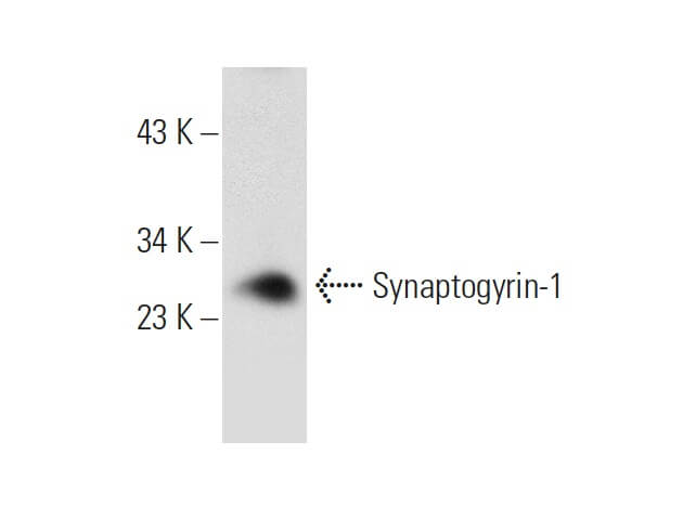 Synaptogyrin 1 Antibody F 4 Scbt Santa Cruz Biotechnology 2498