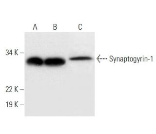 Synaptogyrin-1 Antibody (A-6) - Western Blotting - Image 295892Each CRISPR/Cas9 Knockout (KO) Plasmid product consists of a pool of 3 plasmids designed to ensure identification and cleavage of a specific gene for maximum knockout efficiency. Each plasmid encodes a unique 20 nt sequence derived from the GeCKO (v2) library.