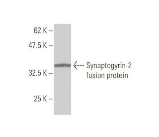 Synaptogyrin-2 Antibody (5C3) - Western Blotting - Image 348988