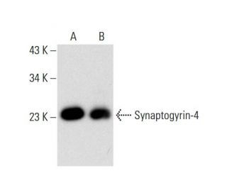 Synaptogyrin-4 Antibody (F-11) - Western Blotting - Image 299236 