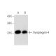 Synaptogyrin-4 Antibody (F-11) - Western Blotting - Image 299236 