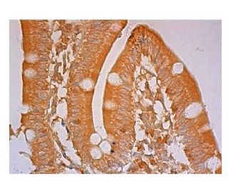 Synaptojanin 2 Antibody (D-11) - Immunohistochemistry - Image 302237 