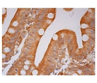 Synaptojanin 2 Antibody (E-1) - Immunohistochemistry - Image 301850 