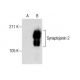 Synaptojanin 2 Antibody (E-1) - Western Blotting - Image 287829 