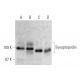 western blotting image from recommended Synaptopodin (D-9) monoclonal antibody replacement. Image 370438