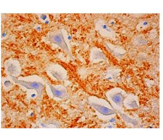 Synaptoporin Antibody (C-9) - Immunohistochemistry - Image 313946 