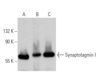 western blotting image from recommended Synaptotagmin I (15) monoclonal antibody replacement. Image 374657