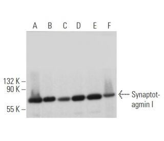 Synaptotagmin I Antibody (15) - Western Blotting - Image 373511SAM Transcription Activation: SAM system utilizing dCas9-VP64, MS2-P65-HSF1, and sgRNA for precise gene transcription activation.